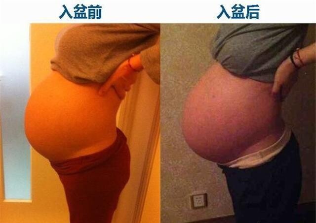 孕6個月 胎兒胎動在肚臍下 這正常嗎 愛問問